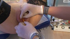 German BDSM doctor games